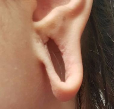 Tunnel Plug - Ohr groß gedehnt - piercen lernen und Piercer werden in der Piercing Ausbildung auf piercen-lernen.de oder piercerfernschule.de I #modsbyben