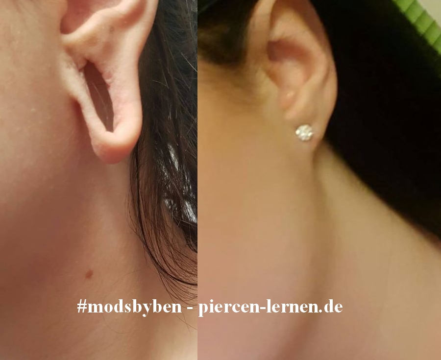 Ohrloch rekonstruieren oder Tunnel Loch ausgeleiert - Cutting, Implantate, Beadings Zungenspaltung sowie Piercing Ausbildung, Piercer werden, Piercing Kurs, Piercer Seminar und Bodymods lernen auf piercen-lernen.de #modsbyben 