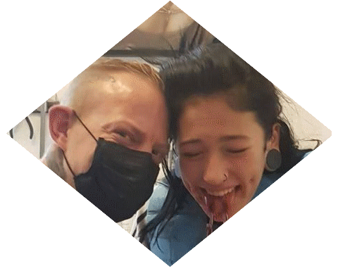 Ben Lucht bei einem Zungenspaltung-Eingriff #modsbyben