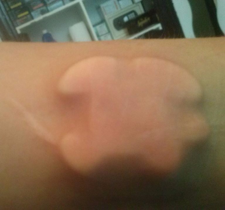 Unikat PTFE Silikon Implantat - Bodymodificationangebot in Deutschland Cutting, Implantate, Beadings Zungenspaltung sowie Piercing Ausbildung, Piercer werden, Piercer Seminar und Bodymod lernen